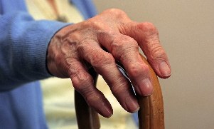 Artrite e artrose dos dedos em uma pessoa idosa