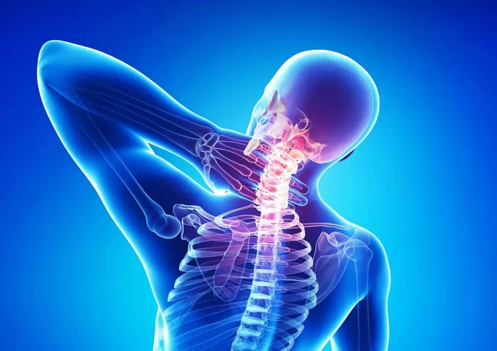 osteocondrose é uma doença da coluna vertebral