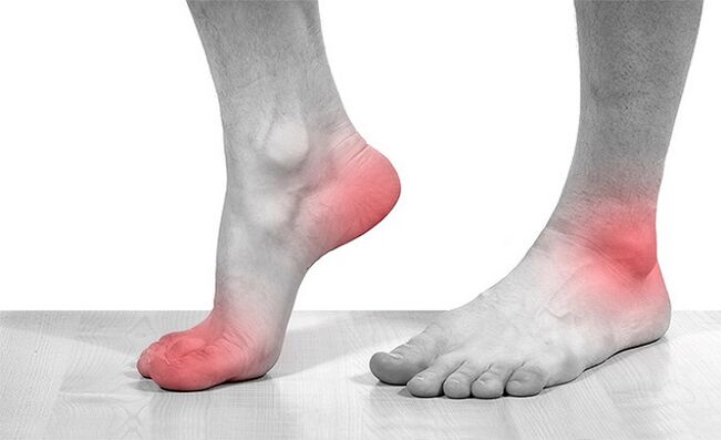 dor nas articulações do tornozelo com artrose
