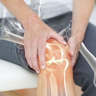Dor no joelho pode ser causada por uma luxação
