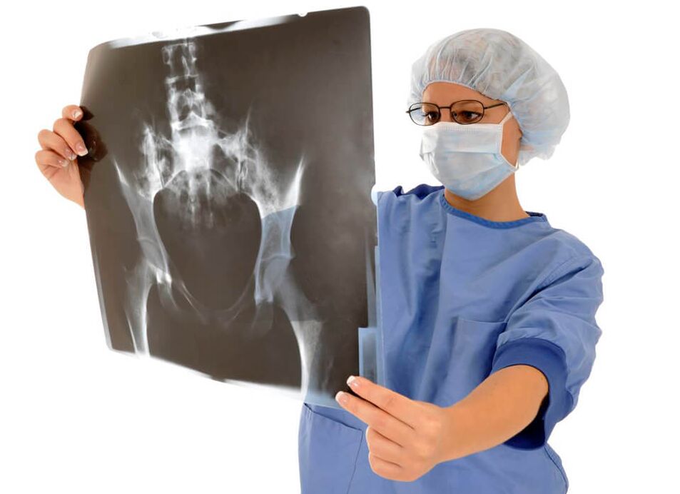 A radiografia da articulação do quadril ajudará o médico a determinar a causa da dor