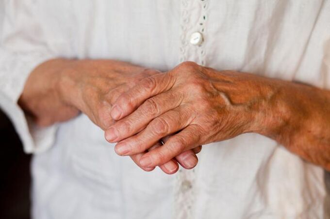 Dor nas articulações das mãos costuma incomodar os idosos