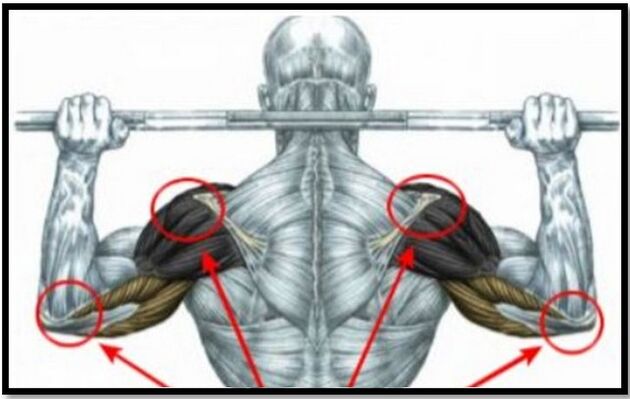 A carga nos músculos do ombro e cotovelo é uma das causas da artrose da articulação do ombro