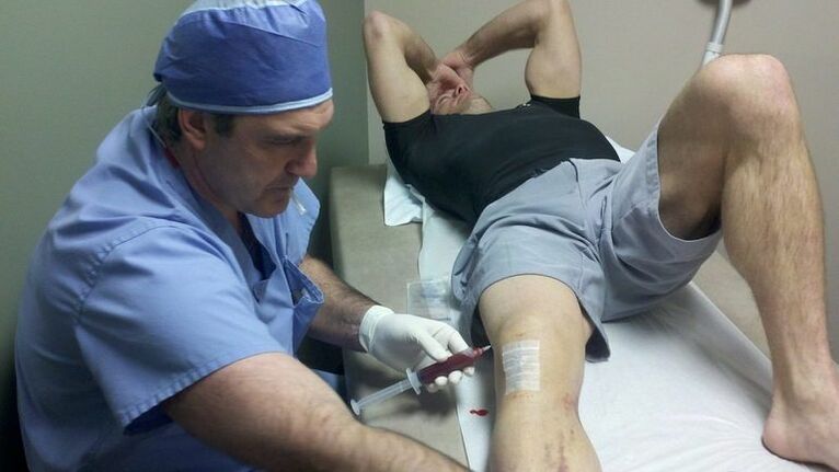 Tratamento da artrose da articulação do joelho