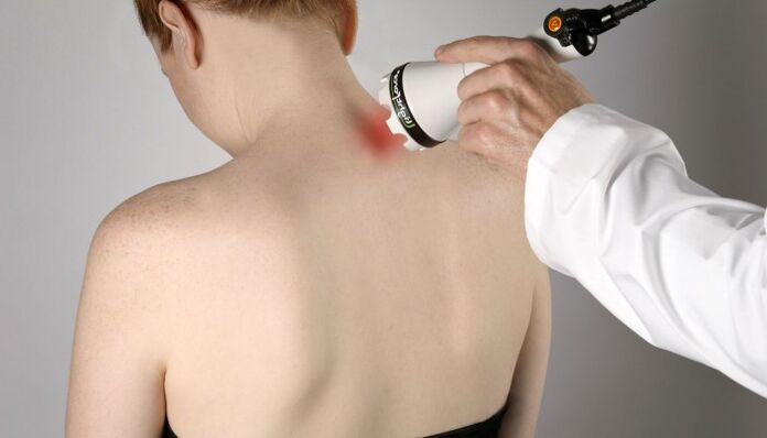 terapia a laser para osteocondrose cervical